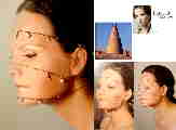 Placeholder  Image